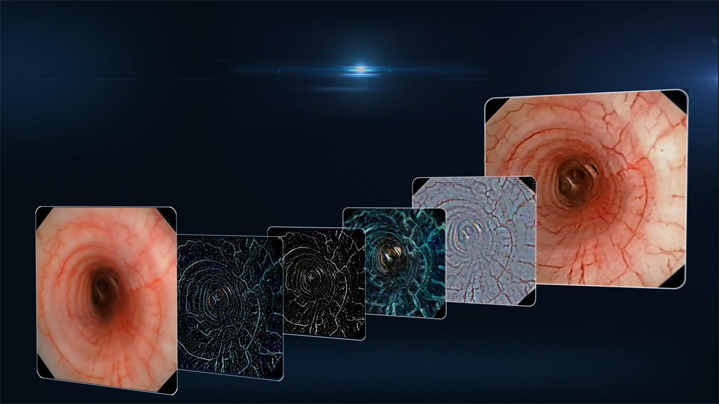 Advanced Image Processing